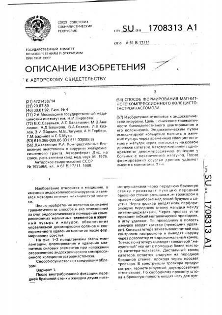 Способ формирования магнитного компрессионного холецистогастроанастомоза (патент 1708313)