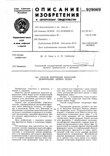 Способ коррекции варусной деформации шейки бедра (патент 929069)