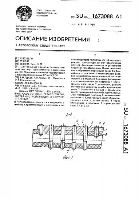 Способ остеосинтеза трубчатых костей и устройство для его осуществления (патент 1673088)