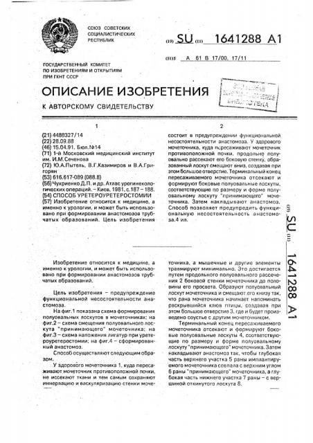 Способ уретероуретеростомии (патент 1641288)