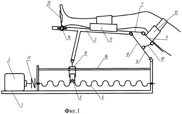 Устройство для восстановления работоспособности коленного и тазобедренного суставов человека (патент 2281077)