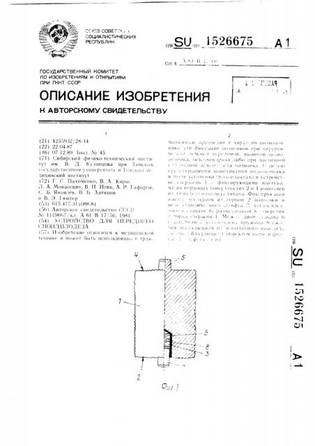 Устройство для переднего спондилодеза (патент 1526675)