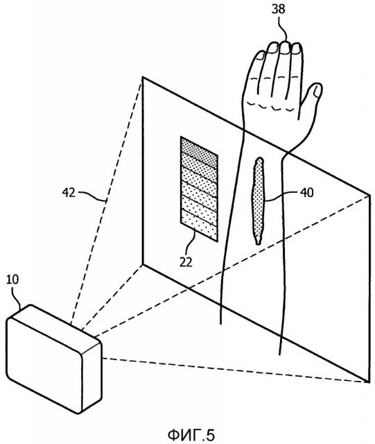Медицинское устройство или система для измерения уровней гемоглобина во время несчастных случаев, используя систему камера-проектор (патент 2652060)