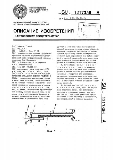 Устройство для предотвращения западания нижней челюсти и языка (патент 1217356)
