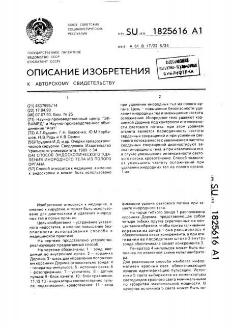 Способ эндоскопического удаления инородного тела из полого органа (патент 1825616)