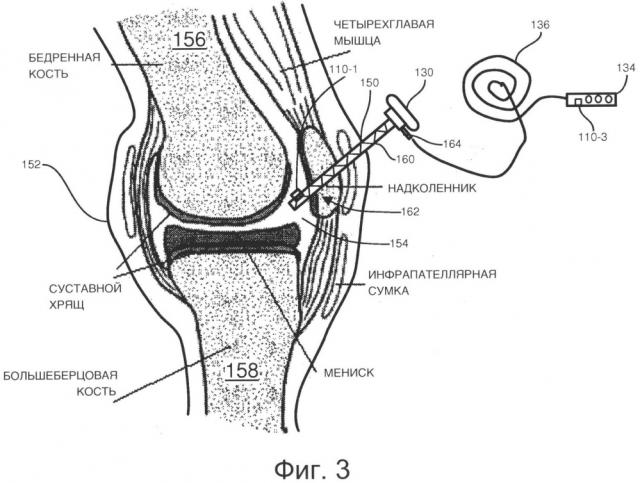 Динамическое хирургическое измерение потока (патент 2607340)