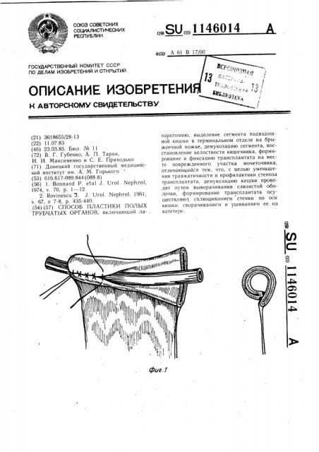 Способ пластики полых трубчатых органов (патент 1146014)