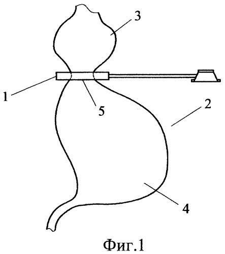 Регулируемое бандажное устройство для желудка (патент 2364374)