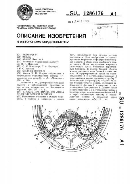 Способ дренирования ложа поджелудочной железы (патент 1286176)