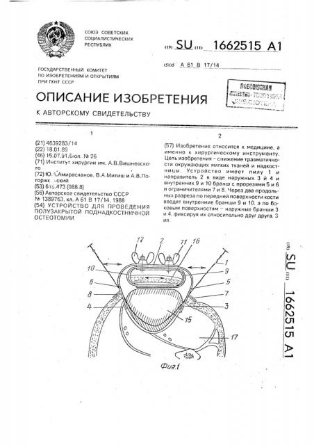 Устройство для проведения полузакрытой поднадкостничной остеотомии (патент 1662515)