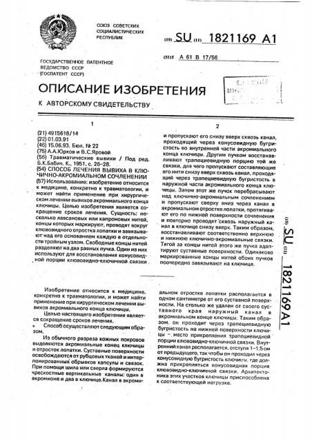 Способ лечения вывиха в ключично - акромиальном сочленении (патент 1821169)