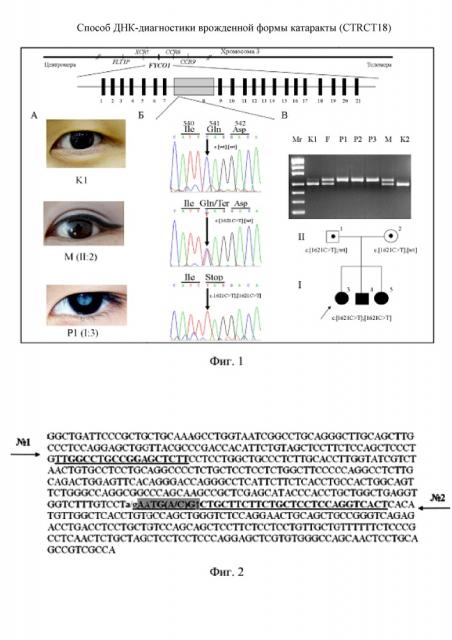 Способ днк-диагностики врожденной формы катаракты (ctrct18) (патент 2648464)