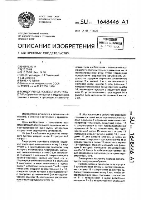 Эндопротез локтевого сустава (патент 1648446)