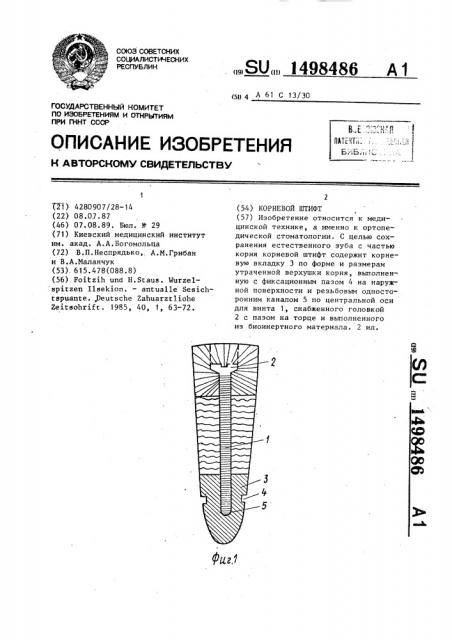 Корневой штифт (патент 1498486)