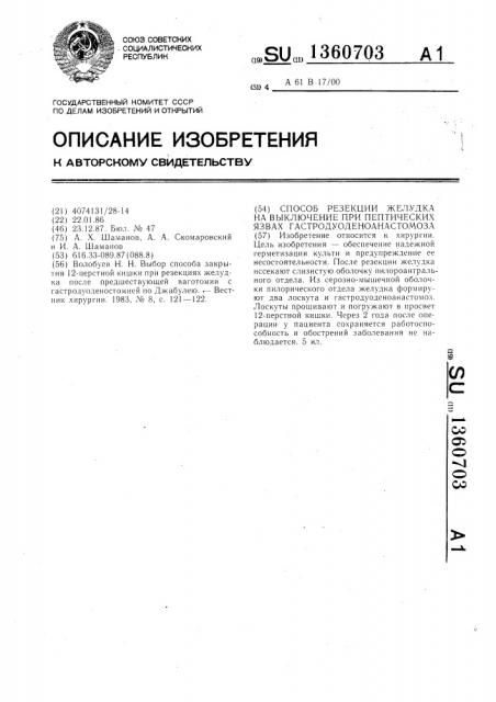 Способ резекции желудка на выключение при пептических язвах гастродуоденоанастомоза (патент 1360703)