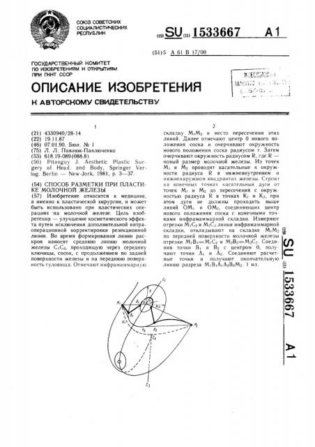 Способ разметки при пластике молочной железы (патент 1533667)