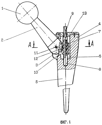 Эндопротез тазобедренного сустава (патент 2265419)