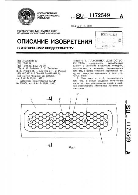 Пластинка для остеосинтеза (патент 1172549)