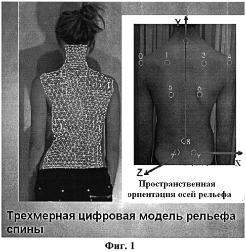 Способ оценки асимметрии формы тела человека по его рельефам (патент 2552884)