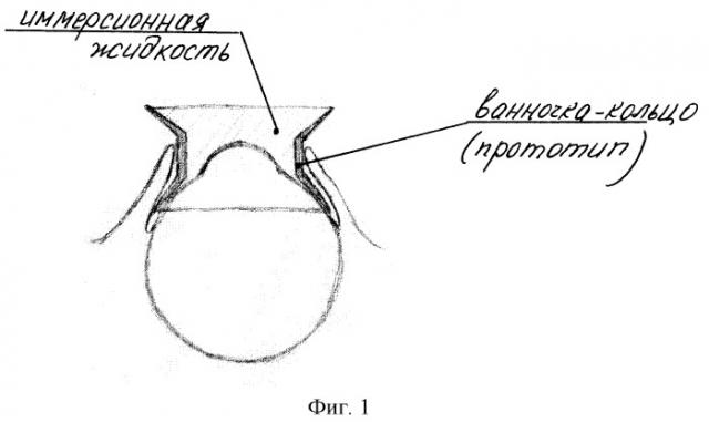 Способ создания объема иммерсионной жидкости при проведении ультразвуковой биомикроскопии переднего отрезка глаза (патент 2251978)