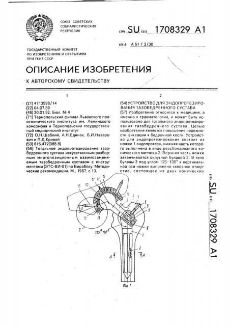 Устройство для эндопротезирования тезобедренного сустава (патент 1708329)