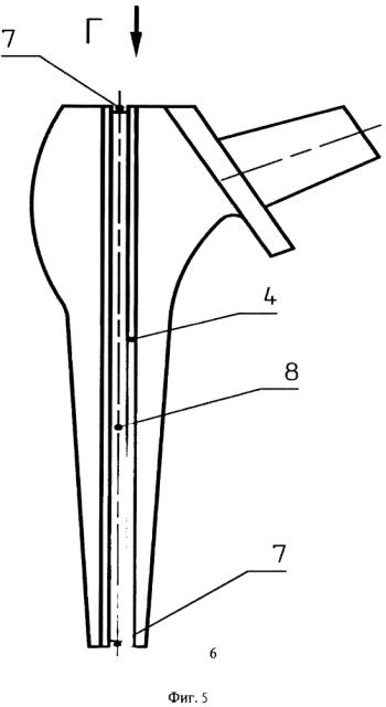 Ножка эндопротеза тазобедренного сустава (патент 2653806)