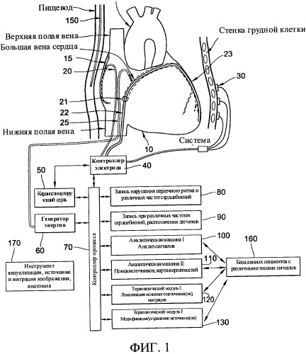 Способы, система и устройство для обнаружения, диагностики и лечения нарушений биологического ритма (патент 2559639)