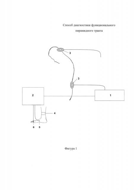 Способ диагностики функционального состояния пирамидного тракта (патент 2652068)