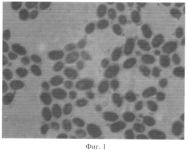 Штамм saccharomyces cerevisiae ts2-06, используемый для изготовления бактериальных препаратов и производства жидкой молочнокислой закваски в качестве продукта питания лечебно-профилактического назначения (патент 2391394)
