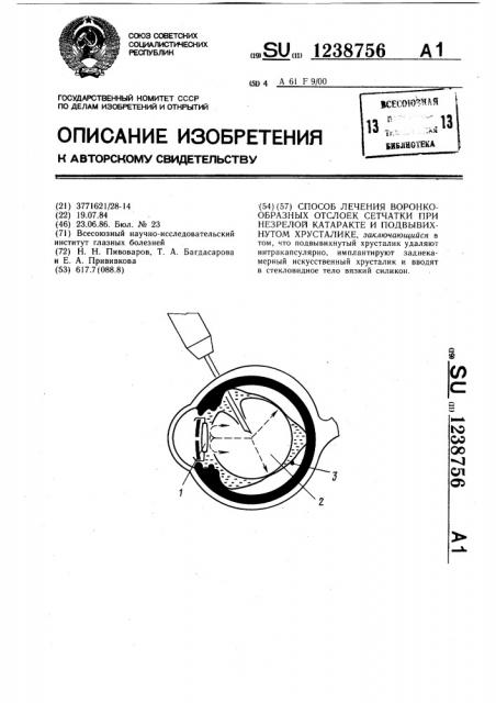 Способ лечения воронкообразных отслоек сетчатки при незрелой катаракте и подвывихнутом хрусталике (патент 1238756)