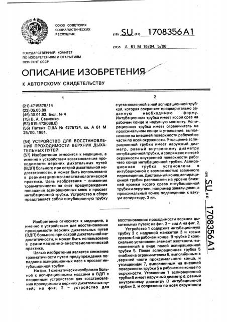 Устройство для восстановления проходимости верхних дыхательных путей (патент 1708356)