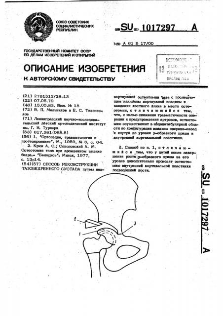 Способ реконструкции тазобедренного сустава (патент 1017297)