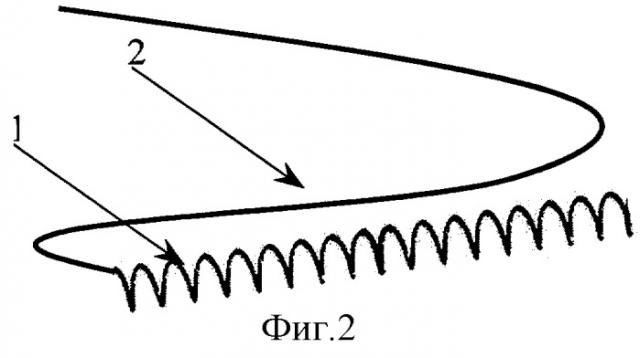 Дренаж мочевых путей (патент 2300399)