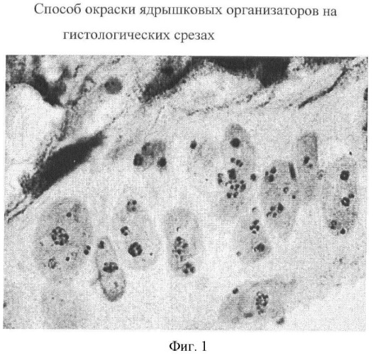 Способ окраски ядрышковых организаторов на гистологических препаратах и цитологических мазках (патент 2447438)