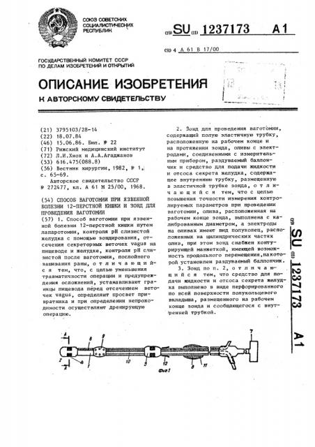 Способ ваготомии при язвенной болезни 12-ти перстной кишки и зонд для проведения ваготомии (патент 1237173)