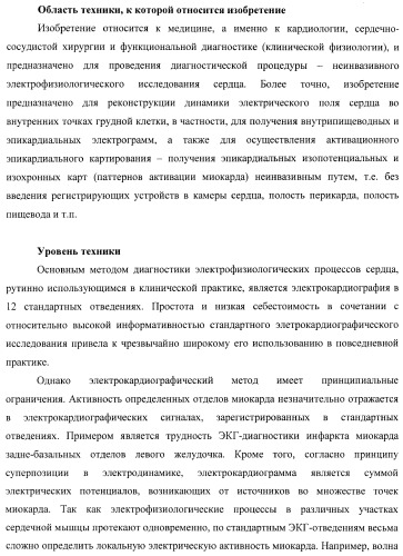 Способ неинвазивного электрофизиологического исследования сердца (патент 2417051)