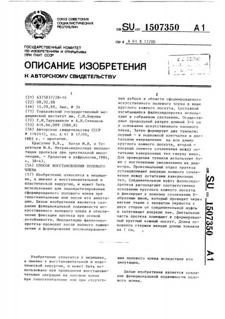 Способ восстановления полового члена (патент 1507350)