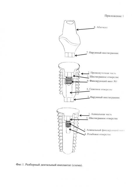 Разборный дентальный имплантат (патент 2593349)
