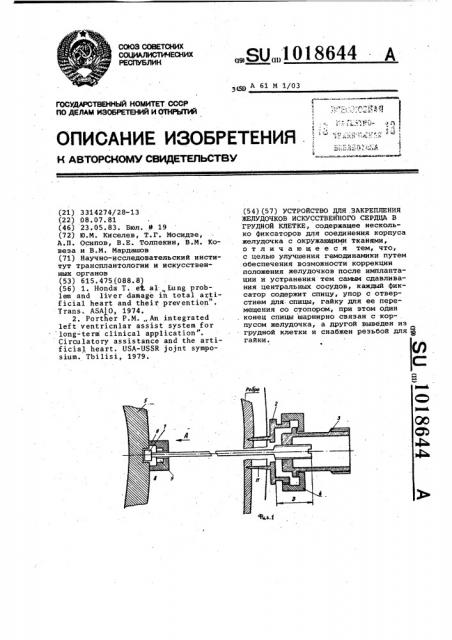 Устройство для закрепления желудочков искусственного сердца в грудной клетке (патент 1018644)